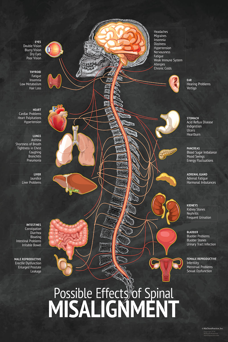 Chiropractic Spinal "Misalignment" Nerve and Symptom Chart