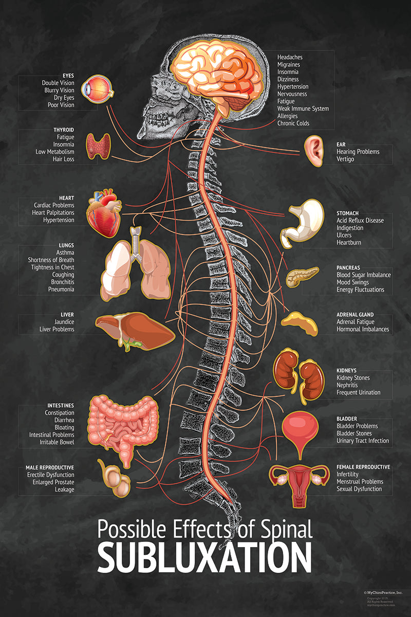 Chiropractic Spinal "Subluxation" Nerve and Symptom Chart