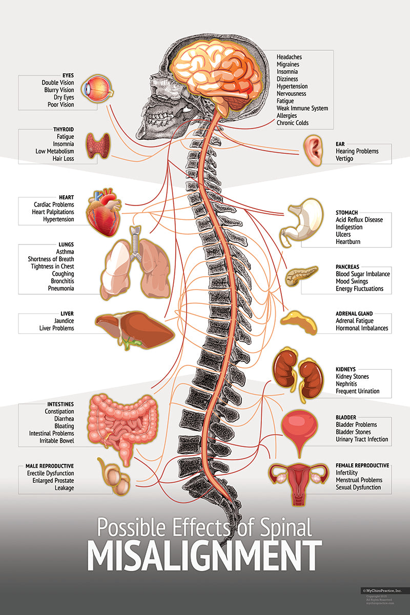 Chiropractic Spinal "Misalignment" Nerve and Symptom Chart