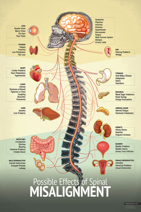 Chiropractic Spinal "Misalignment" Nerve and Symptom Chart