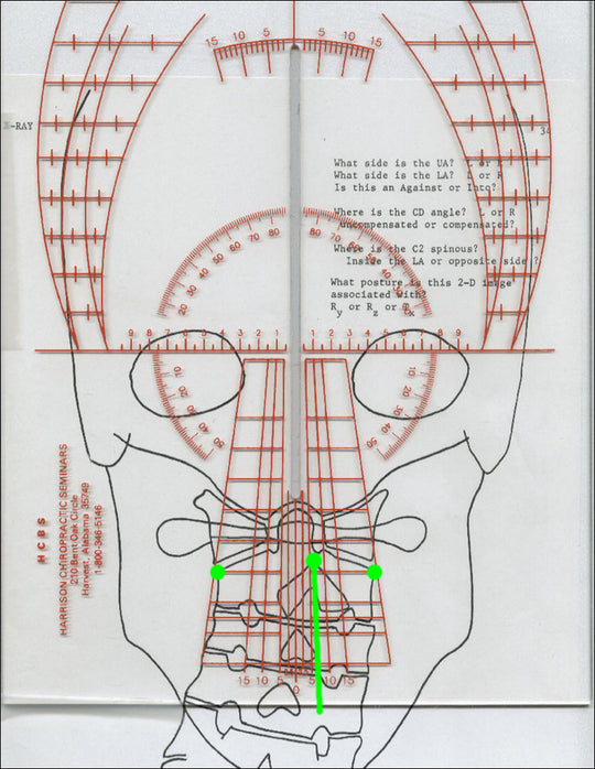 Orthogonal X-Ray Instrument