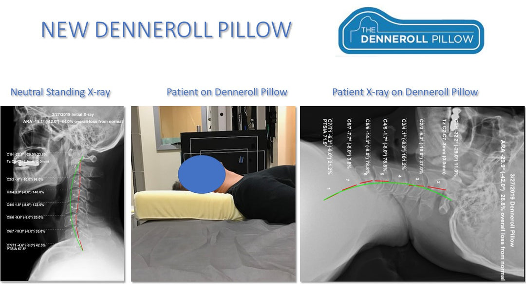 The Denneroll Pillow