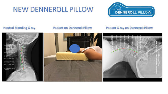 The Denneroll Pillow